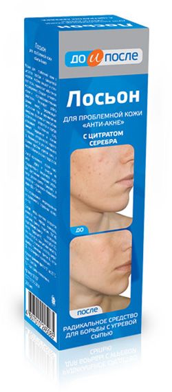 Изображение товара Лосьон для проблемной кожи «До и после» анти-акне, 200 мл Лосьон для проблемной кожи «До и после» анти-акне, 200 мл фотография